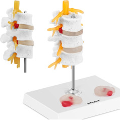 Mugurkaula jostas daļas 3D anatomiskais modelis ar trūces skriemeļiem 3-5