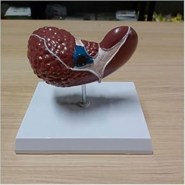 HEAIYB Anatomiemodell Leberorganmodell Lebergewebeläsionsmodell 1:1 Pathologisches Leberanatomiemodell Orgelmodell