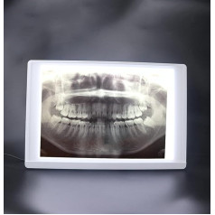 Lab Equipment Film Illuminator Light Box Viewer Light Panel Screen