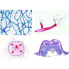 Lieder Biology Microscopy Micropreparations Series: Sponges and Hollow Animals (Coelenterata, Porifera), Extended Series, 10 Preparations