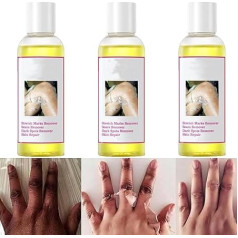 Starkes Peelingöl, gelbes Peelingöl, Peelingöl geeignet für dunkle Haut geeignet, geeignet für alle Hauttypen, körpertote Hautentferner, geeignet für Körper, Hände und Füße geeignet