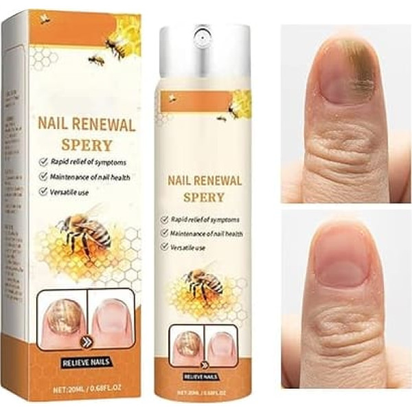 C Vreoz Bee Veno M Nail Renewal Spray, Toenail Liquid Treatments, Fingernail Care Spray, Deep Nourishment & Hydration, Easy to Apply, 3.8 x 3.8 x 14.5 cm, for Home or Travel