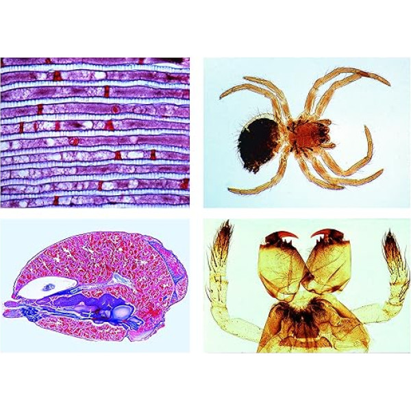 Lieder Micropreparation Series: Arachnoid and Centipedes (Arachnoidea, Myriapoda), Extended Series, 12 Preparations